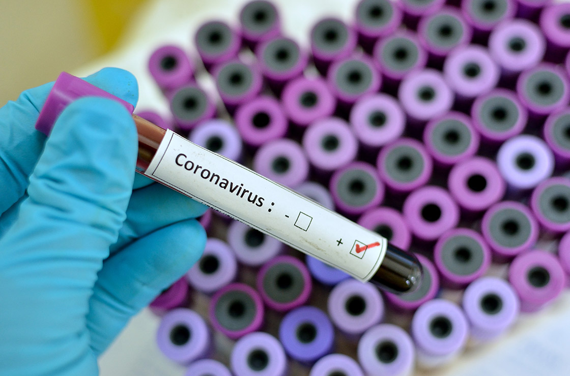 What is Coronavirus?