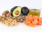 brain health probiotic foods like avocados